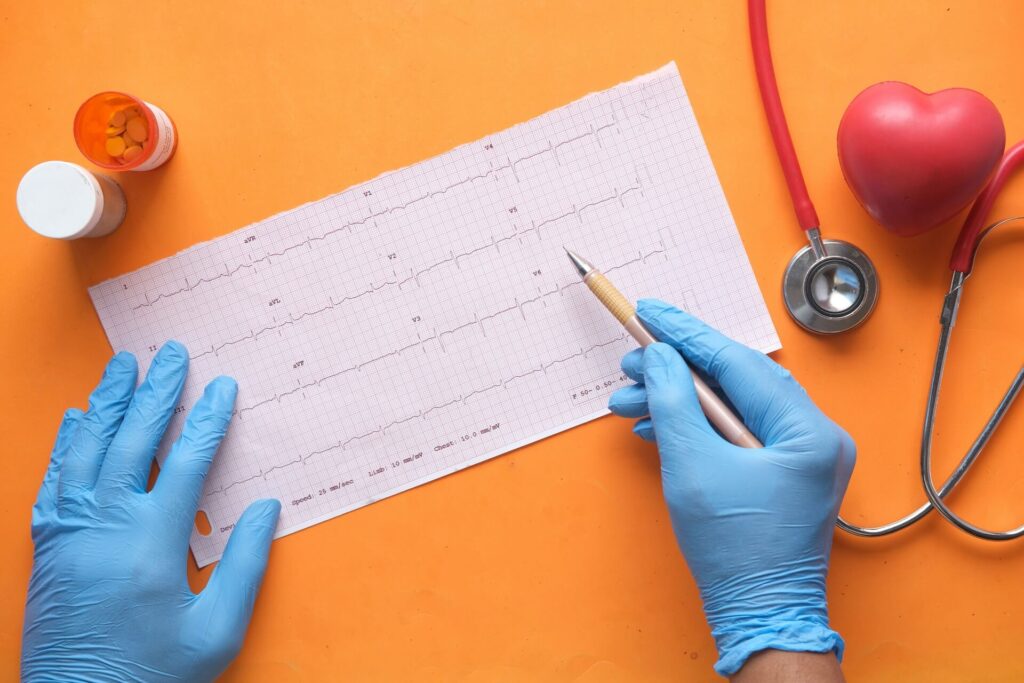 A pair of gloved hands near at a heart rate prinout